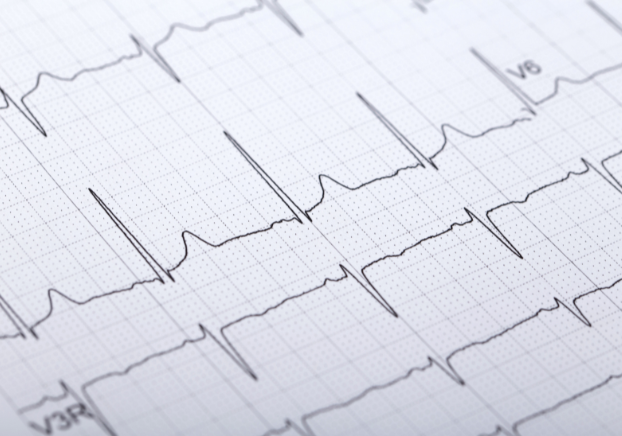 Electrocardiogram chart