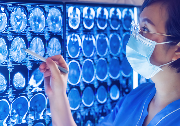 Female nurse looking at MRI scan 